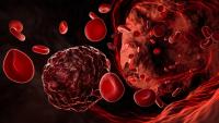Cancer cell or cancerous tumor amidst flowing red blood cells in a blood vessel, artery or vein 3D rendering illustration. Medicine, pathology, oncology, disesase, science concepts. | Image Credit: © Matthieu - stock.adobe.com