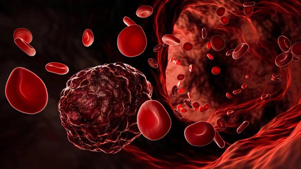 Cancer cell or cancerous tumor amidst flowing red blood cells in a blood vessel, artery or vein 3D rendering illustration. Medicine, pathology, oncology, disesase, science concepts. | Image Credit: © Matthieu - stock.adobe.com