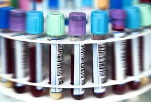 Genetic Testing