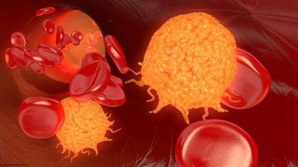 Updated results from the phase 2 ELIANA trial support tisa-cel as definitive therapy for pediatric and young adult patients with relapsed/refractory B-ALL.