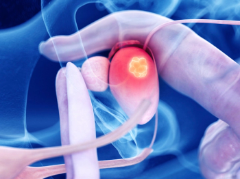 Avelumab Plus Trilaciclib Elicits Responses in Phase 2 Urothelial Carcinoma Study