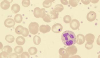 Results from the phase 3 AVA-PED-301 trial support the FDA decision for avatrombopag in pediatric thrombocytopenia.