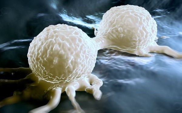 Oncotype DX 21-gene recurrence scores may help select certain patients who are suitable to omit radiotherapy for early-stage breast cancer.