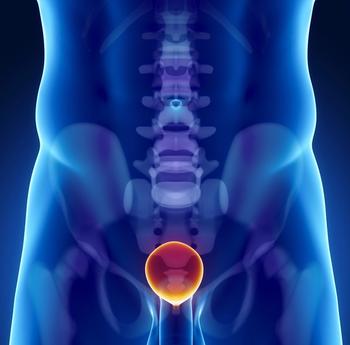 The addition of prostate radiation therapy to androgen deprivation therapy appears to be cost effective in patients with low-volume metastatic hormone-sensitive prostate cancer. 