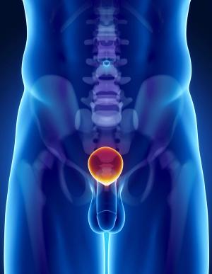 Previous results from the study found improvement in the primary end point of PSA-PFS with apalutamide in recurrent prostate cancer.