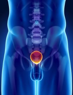 Novel PSMA-TRT-based Triplet Regimen Appears Effective in Prostate Cancer