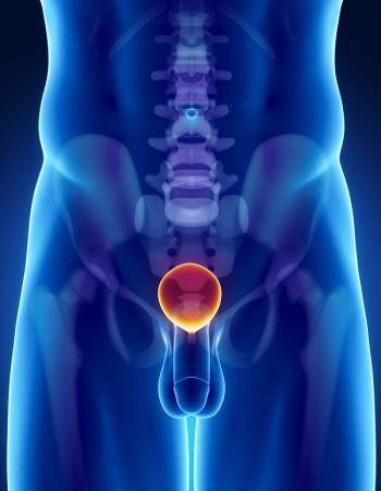 Updated safety findings may support the ARASAFE regimen as a potential standard of care in metastatic hormone-sensitive prostate cancer.