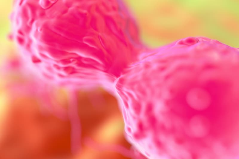Treatment with zanubrutinib may be a viable option for patients with B-cell malignancies who are intolerant to acalabrutinib, says Mazyar Shadman, MD.