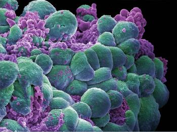 Data from the phase 3 DESTINY-Breast09 trial presented at the 2025 ASCO Annual Meeting formed the basis of the supplemental NDA. 