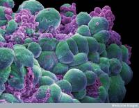Sac-TMT demonstrated a significant improvement in PFS vs chemotherapy as first-line treatment for unresectable locally recurrent or metastatic TNBC.