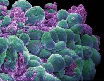 Data from the phase 3 DESTINY-Breast09 trial presented at the 2025 ASCO Annual Meeting formed the basis of the supplemental NDA.