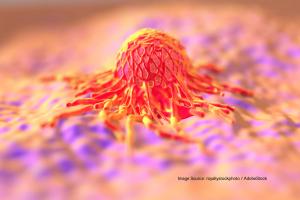Samples were analyzed using 40-GEP clinical testing standard operating procedures. The trial end points were LRFS and MFS.