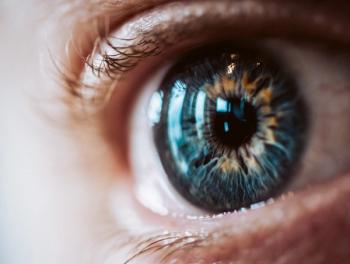 A subset of patients with metastatic uveal melanoma achieved promising responses after treatment with entinostat and pembrolizumab.