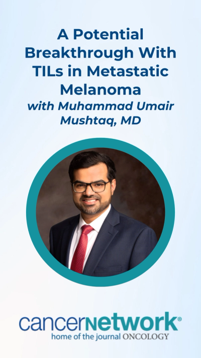 A Potential Breakthrough With TILs in Metastatic Melanoma