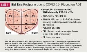 Managing Prostate Cancer Surgical Patients during the COVID-19 Pandemic: A Brief Report of the Duke Cancer Institute’s Initial Experience