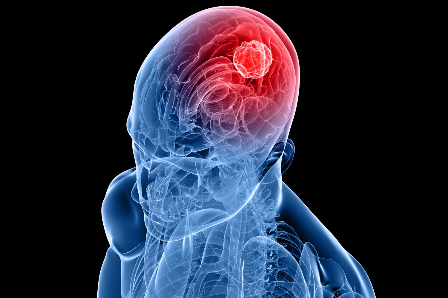 FDA Clears REGAIN Trial | Image Credit: SciePro - iStock - Getty Images Plus