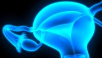 Relacorilant Maintains OS Benefit in Ovarian Cancer Despite Prior Taxane Use