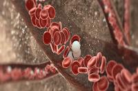 Orelabrutinib Improves Progression-Free Survival in Treatment-Naive CLL/SLL