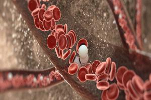 Pacritinib Boasts Comparable Safety Profile to Best Available Therapy in Myelofibrosis Treatment