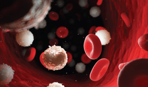 The Evolving Role of Radiation Therapy in DLBCL: From Early-Stage to Refractory Disease