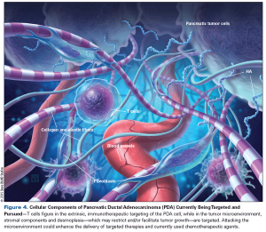 Current Standards and Novel Treatment Options for Metastatic Pancreatic Adenocarcinoma