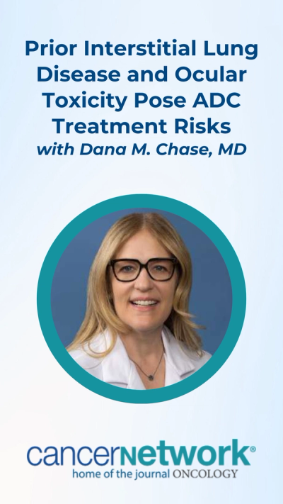 Prior Interstitial Lung Disease and Ocular Toxicity Pose ADC Treatment Risks