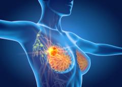 EP. 7 Sequencing ADCs and Managing Ocular Toxicities in Breast Cancer Populations