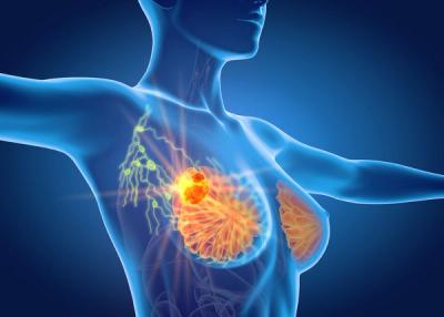 ADCs May Be Emerging As Preferred Backbone in HER2+/HR+ Breast Settings