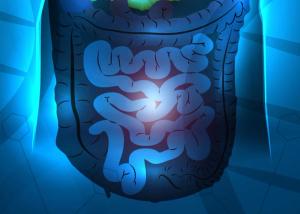 Minimal Residual Disease–Directed Adjuvant Therapy for Patients With Early-Stage Colon Cancer: CIRCULATE-US