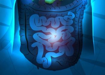 Minimal Residual Disease–Directed Adjuvant Therapy for Patients With Early-Stage Colon Cancer: CIRCULATE-US
