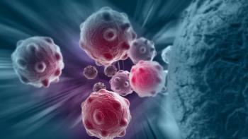 Addition of Transplant to RVd and Lenalidomide Maintenance Led to PFS Boost for Treatment Naïve Myeloma