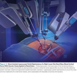 Contemporary Issues Surrounding Small Renal Masses: Evaluation, Diagnostic Biopsy, Nephron Sparing, and Novel Treatment Modalities