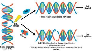 Nausea and Vomiting: Managing Side Effects From PARP Inhibitors