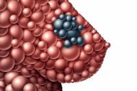 Data from a phase 2 study may support a novel mTOR inhibitor-based regimen in previously treated, HR-positive, HER2-negative breast cancer.