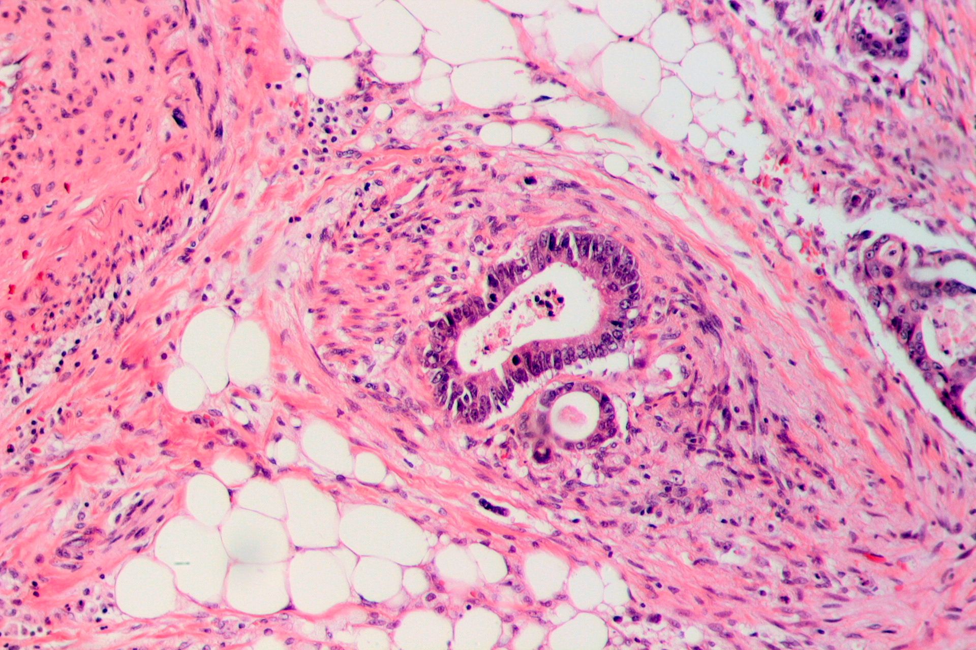 Prospective, real-world data indicate that most patients with colon or rectal cancer who undergo surgery remain independent.
