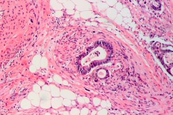 Investigators found that patients with non–gain-of-function TP53-mutant right-sided metastatic colorectal cancer and gain-of-function TP53-mutant left-sided tumors had poorer survival vs their counterparts.