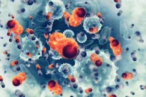 Phase 1b/2 BGB-11417-105 trial data showed low rates of high-grade infection and hematologic toxicity with sonrotoclax-based therapy in multiple myeloma.