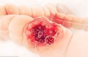 The recommendation was made following mid-stage, end-of-phase 2 data for the botensilimab/balstilimab combination, which yielded lower responses in patients.