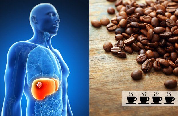 Coffee and liver cancer risk