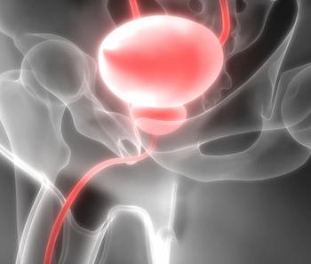 225Ac-LNC1011 targeted α therapy elicited an ORR of 50.0% in patients with PSMA-positive prostate cancer in a phase 1 trial.