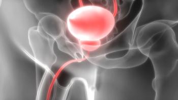 “The proportion of patients receiving prostatectomy for grade group 1 prostate cancer has declined 5-fold since 2010,” according to the study authors.