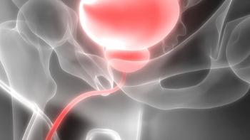 225Ac-LNC1011 targeted α therapy elicited an ORR of 50.0% in patients with PSMA-positive prostate cancer in a phase 1 trial.