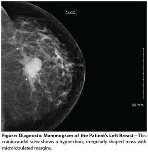 Management of Young Breast Cancer Patients With de Novo Genetic Mutations  