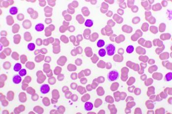 chronic myeloid leukemia