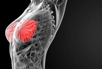 Breast Cancer