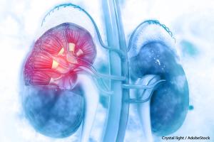 Rana R. McKay, MD, on the Impact of the Phase II OMNIVORE Trial