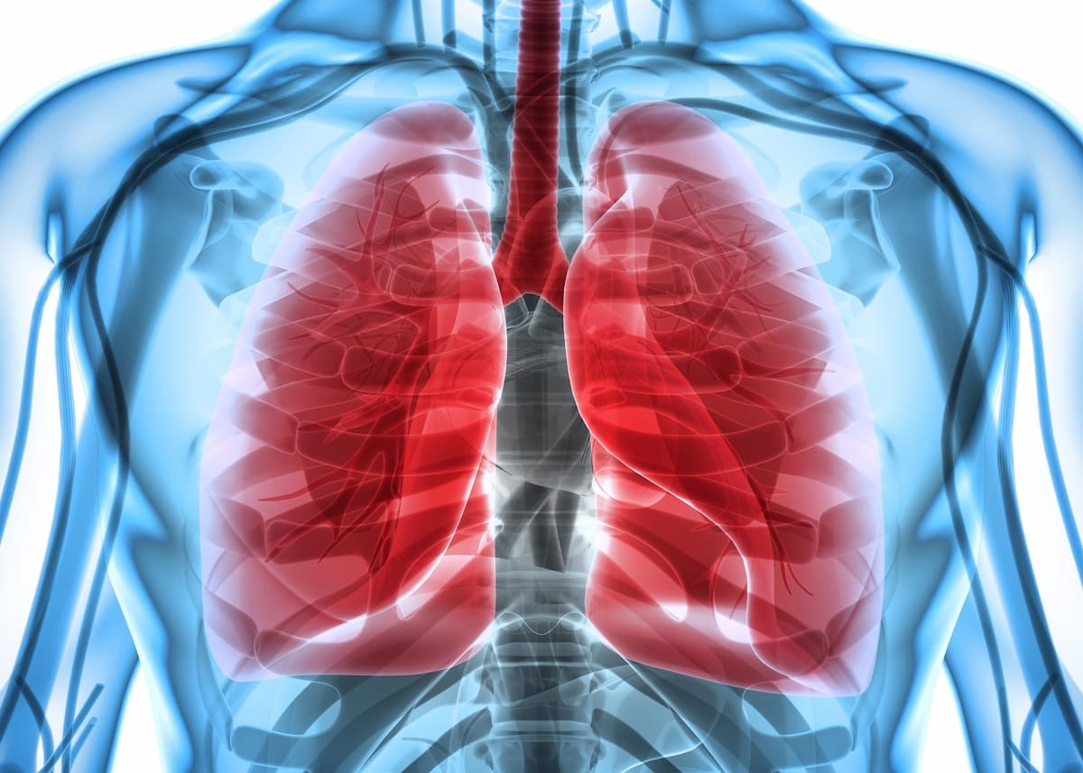 what does the end stages of copd look like