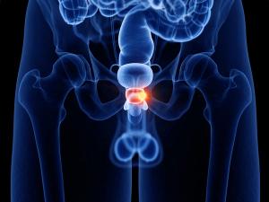 Personalized Treatment Plans for Certain Patients with BRCA-Mutated mCRPC