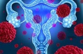 ovarian cancer