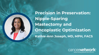 Precision in Preservation: Nipple-Sparing Mastectomy and Oncoplastic Optimization